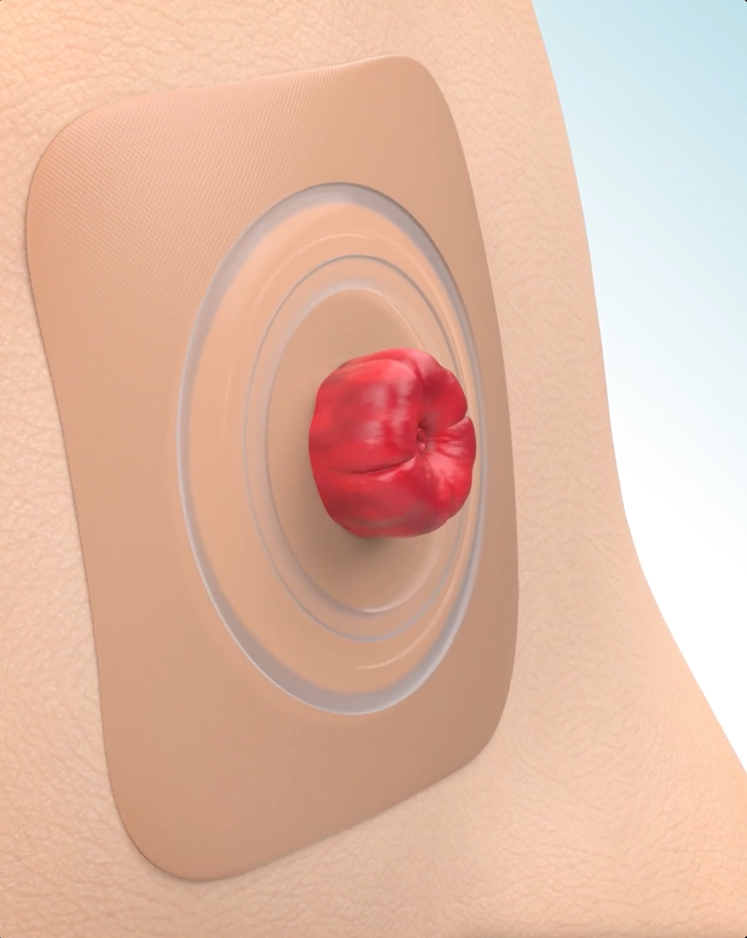 コンバテックの粘着剤のしくみを説明するビデオ