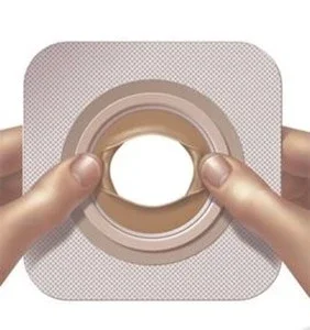 ConvaTec Moldable Technology™ hudbarriär