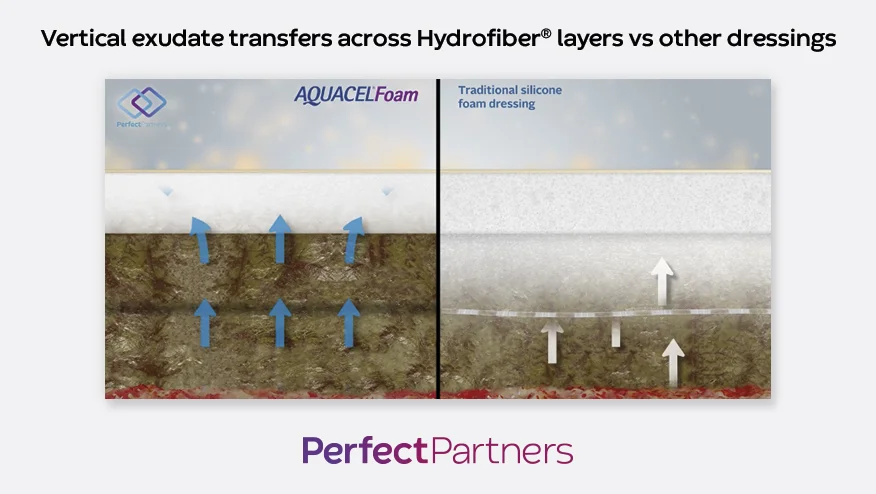 Comparison of vertical exudate transfer across Hydrofiber layers in Extra, Foam, and a traditional silicone foam dressing.