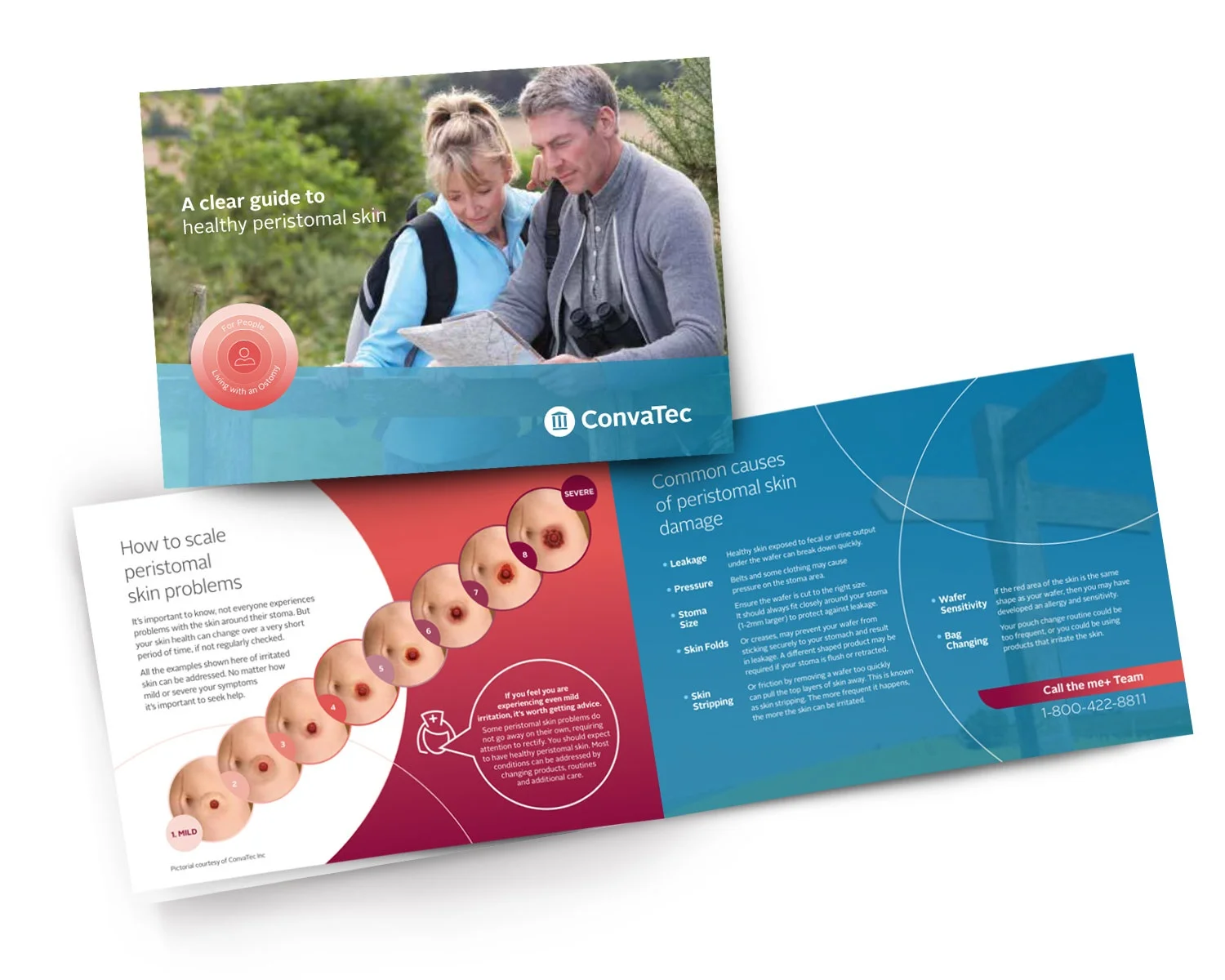 En forside af brochuren: 'Clear Guide to Healthy Peristomal Skin' dykker ned i skaleringsproblemer og almindelige årsager til hudskader.